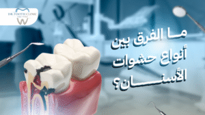 مالفرق بين أنواع حشوات الأسنان؟ دليل شامل لكل نوع