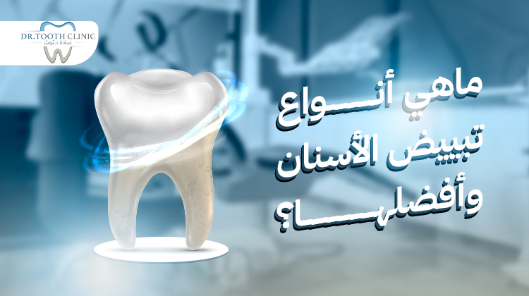 انواع تبيض الأسنان