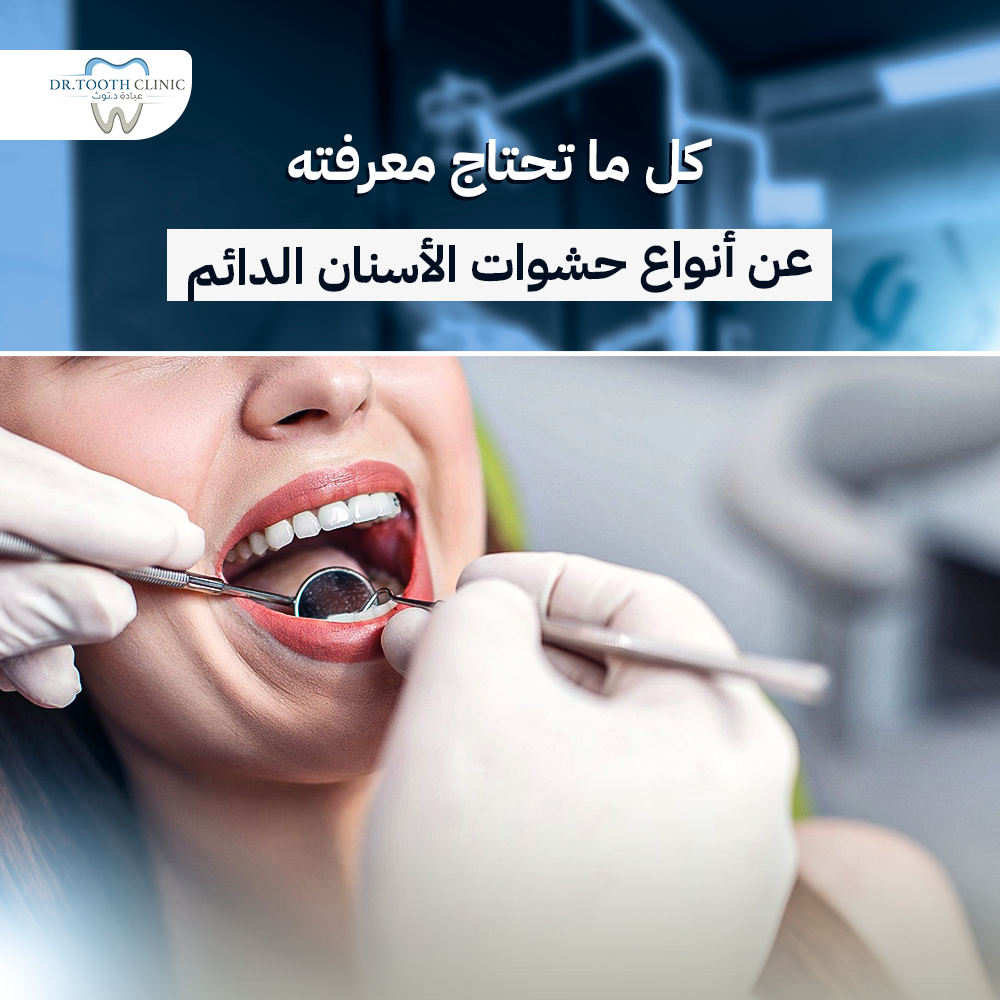 كل ما تحتاج معرفته عن أنواع حشوات الأسنان الدائمة