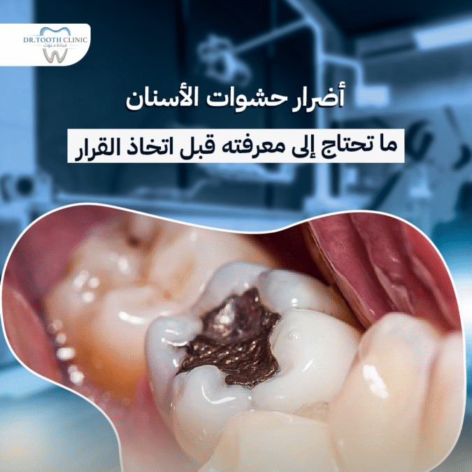 اضرار حشوات الاسنان