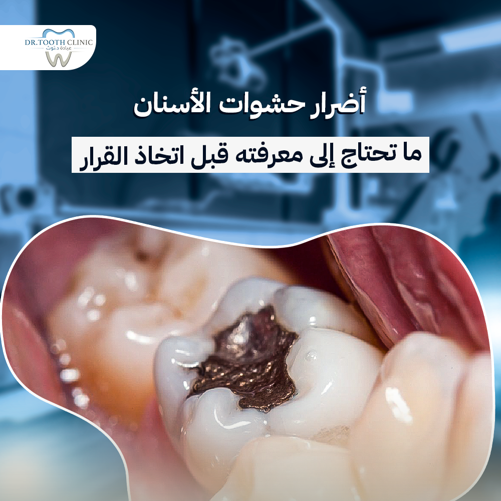 أضرار حشوات الأسنان: ما تحتاج إلى معرفته قبل اتخاذ القرار