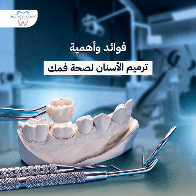 ترميم الاسنان