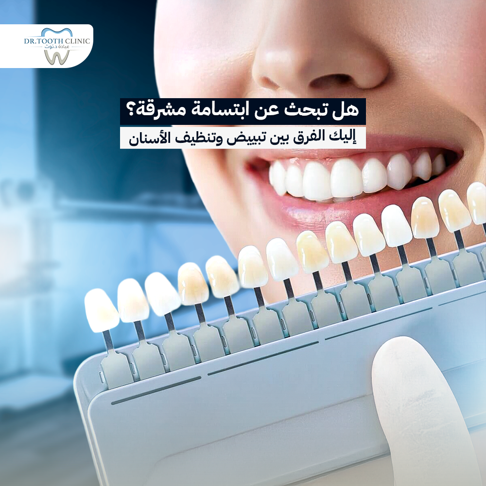 هل تبحث عن ابتسامة مشرقة؟ إليك الفرق بين تنظيف وتبييض الاسنان