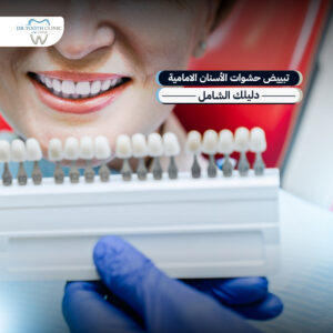 تبييض حشوات الأسنان الامامية: دليلك الشامل