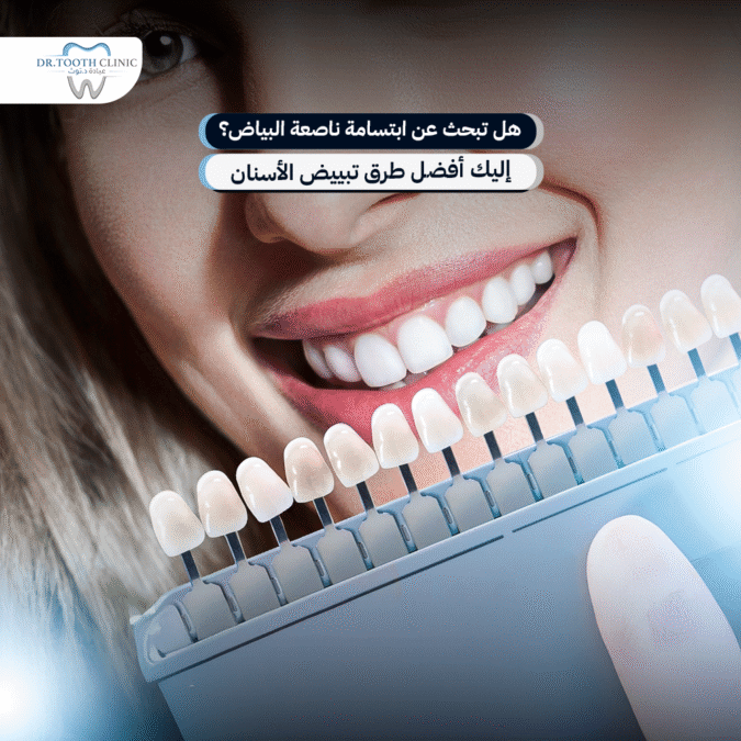 طريقة تبيض الاسنان