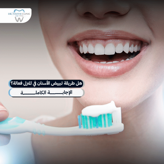 طريقة تبيض الاسنان في المنزل