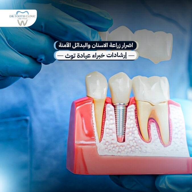 اضرار زراعة الاسنان