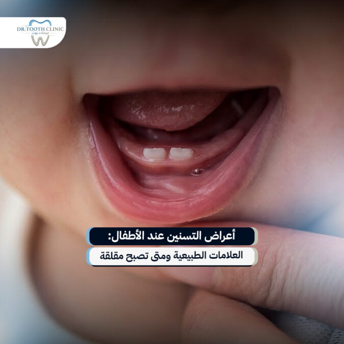 اعراض التسنين عند الاطفال