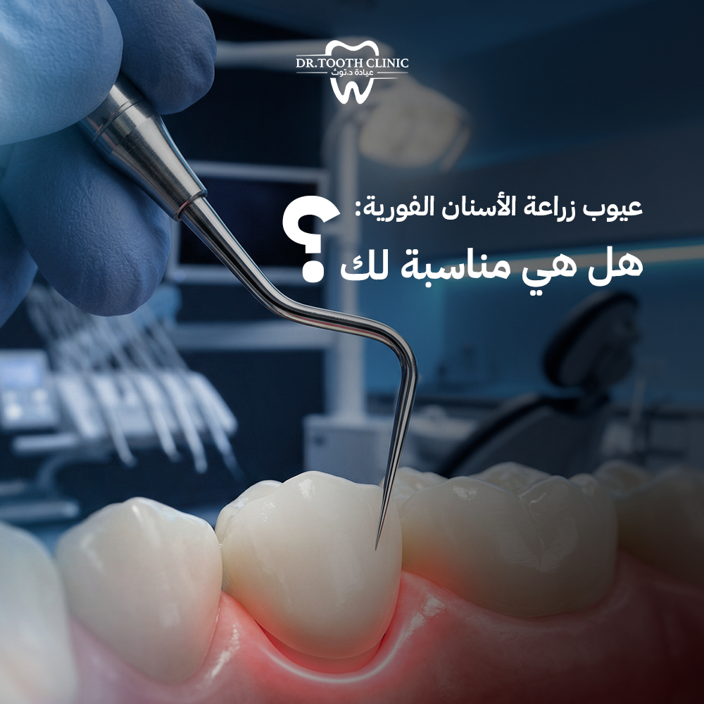عيوب زراعة الأسنان الفورية: هل هي مناسبة لك؟