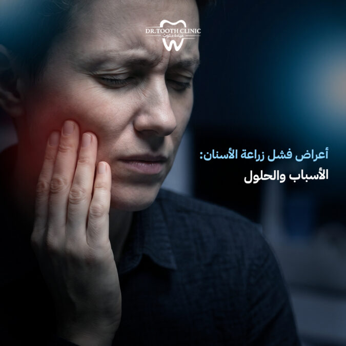 أعراض فشل زراعة الأسنان
